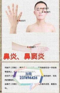 成人鼻炎灸针灸视频,视频详解,轻松缓解鼻炎不适