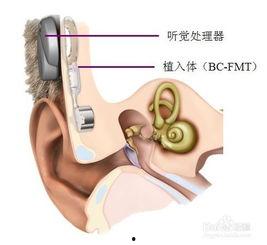 成人耳蜗训练视频,开启听觉新篇章